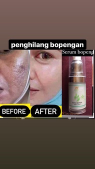SERUM BOPENG SWF SKINCARE