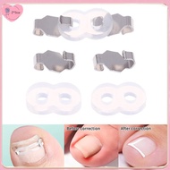 【Z*Star】 1/2 Set Ingrown Toenail Corrector Tools Pedicure Recover Embed Toenail Treatment Foot Care 