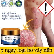 Anti-itch cream 30ml dangkhoa anti-itch cream