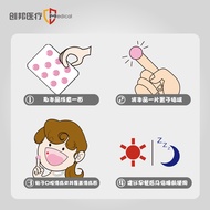 Patch Oral Ulcer Medical State 3.27 Pregnant Women Film Patch Oral Ulcer Oral Injury Oral Ulcer Chil