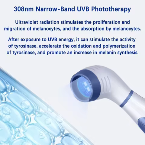 308nm Household Ultraviolet Phototherapy Instrument, Vitiligo Treatment, UVB Lamp Laser for Therapy,