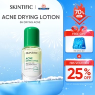 [NEW LAUNCH] SKINTIFIC Acne Drying Lotion Salicylic Acid Acne spot treatmen Acne Scar Serum Essence