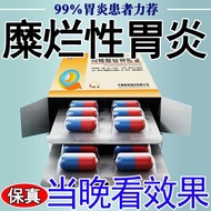 Hengji Bismuth Potassium Citrate Capsules 0.3g*12 capsules/b恒基 枸橼酸铋钾胶囊 0.3g*12粒/盒 治胃病糜烂性胃炎胃溃疡慢性胃病胃痛腹