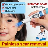 Laser Scar Removal Pen – Effective for Keloids, Acne Scars & Surgical Scars Acne Scar Removal Scar G