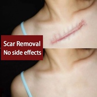 Snake Oil Cream Lavender Scar Repair Cream Restores Elasticity 蛇油膏套装 Scar Gel 30g+30g Scar Treatment