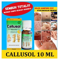 BIG SALE Callusol obat mata ikan murah penghilang kutil di tangan kaki leher obat perontok kapalan d