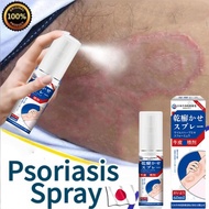 Ubat gatal kulit Ubat kurap Obat gatal Psoriasis Relief Spray Kulit Itchy Skin Relief Anti Itch Topi