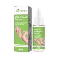 ....#Ximonth Nail Repair Serum Manicure and Pedicure Gentle Nail Care Nail Polish Nourishing Toenail