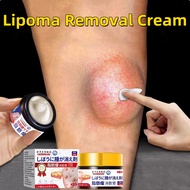 Lipoma Removal Cream Original subcutaneous Lipoma Elimination Benjolan Fat Lump Lipoma Hard Lumps Fa