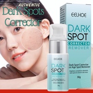 Dark Spots Corrector Remover Dark Spot Corrector Daily Face Serum, Eelhoe Dark Spot Cream, Dark Spot Cream, Dark Spot Cream Authentic