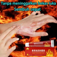 Obat Luka Agar Cepat Kering - Salep Herbal ShaoTang Shang 20gr - Menghilangkan Bekas Luka Knalpot Air Panas-Untuk Luka Bakar-Obat penghilang bekas luka bakar-Salep luka bakar Penghilang Bekas Luka-Menghilangkan Bekas Luka Bakar