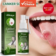 Ulcer Breath Sprays,Mouth Ulcers Repair Spray,Ulcer ,Canker Sore Treatment,Canker Spray,Herbal Mouth