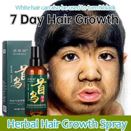 （SG local sellers）Hair Growth Serum Herbal Hair Growth Spray 100ML Hair Growth For Men And Women Ant