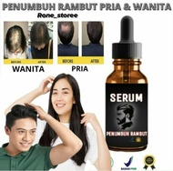 PROMO NAMPOLL Penumbuh Rambut / Penumbuh rambut botak pria / Serum penumbuh rambut / Penumbuh rambut