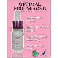 Marwah Optimum ACNE SERUM | Acne SERUM