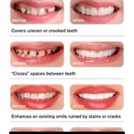 Snap on smile ORIGINAL gigi palsu atas bawah instan pemutih gigi murah