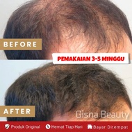 ( 2 BOTOL HASIL MAKSIMAL ) Penyubur Rambut Paling Ampuh Vitamin rambut rontok dan penyubur Penumbuh 