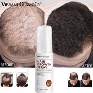 VIBRANT GLAMOUR Hair growth serum Spray Fast hair grower for man and woman Minoxidil Scalp Hair fall