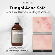 [La Théorie] 0% Fatty Acids Fungal Acne Safe Cleanser (210ml)