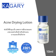 [ ซือ1แถม1 ] KAGARY Anti-acne serum Acne Drying Lotion กรดซาลิไซลิกเซรั่มกําจัดสิว ช่วยให้สิวยุบเร็ว