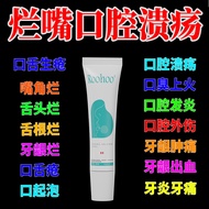Oral Ulcers Pain Red Swelling Tongue Foaming Fire on the Mouth Burning Pain Reduce Swelling Gel 25.4