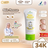 YummysBaby Skin Rescue Cream | Treat Sensitive & Irritated Skin | Moisturizes & Softens Baby's Skin