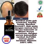 MINYAK PNUMBUH RAMBUT-SERUM PENUMBUH - Penumbuh Rambut Secara Cepat / Obat Penumbuh Rambut Botak Super Cepat BPOM / Penyubur Rambut Rontok Pria Wanita / Minyak Rambut Kemiri Asli