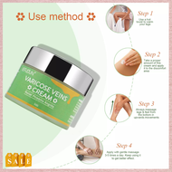 SEFUDUN Varicose Vein Treatment Cream Spider Vein Pain Varicosity Effective Varicose Healing Cream V