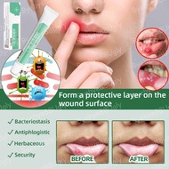 ORAL ULCERS OINTMENT ORAL PASTE Aphthous mouth ulcer gel effective bacteriostatic ointment tongue fire mass blister repair Bad Breath Aid Gel Canker,denture irritation,No Alcohol Antibacterial Pain Relief Medicine Lip Acne 口腔潰瘍藥膏 20g