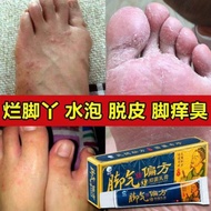Jiaoqipianfang Anti Bacterial Cream, Krim Herba Anti Kulat melegakan sakit dan gatal, sesuai untuk k