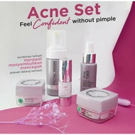 MS Glow Acne 1 Paket + Serum Acne Original BPOM - Menekan Minyak Berlebih Dan Mencegah Masalah Jeraw