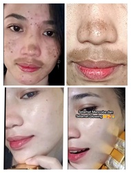 JS SKINCARE KRIM FLEK AMPUH