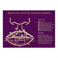 Large Size DermatologistDesigned Hyaluronic Acid Lip Injection Guide  Lip Anatomy  Filler Art Poster