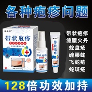 Specially effective post-herpetic neuralgia, herpes zoster pain, snake sore cream,特效疱疹后遗神经痛带状疱疹疼蛇盘疮膏