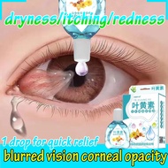 Eye Drop-15g|hyssop eye drops original/rohto eye drops/eyedrop care eye dropper from japan