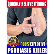 Antifungal cream, anti-itch cream, psoriasis cream, relieve itching, effective against fungal infect