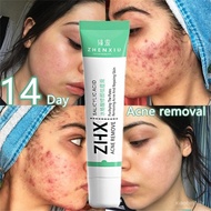Acne Cream Scar Removal Facial Acne Treatment Acne Spot Treatment Gel Pimple Cream Cl