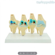 【In stock】Un* Human Knee Joint Skeleton Model Life Size Medical Comparison of Knee Joint Diseases Mo