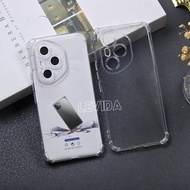 Honor 400 5G Honor 400 Pro Case Airbag Clear Case Shockproof Case Honor 400 5G Honor 400 Pro AB-01