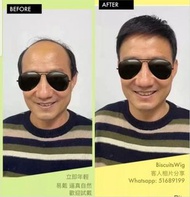 香港假髮專門店Biscuits 男士頭頂真髮 假髮髮片可專業訂製 推薦假髮 假髮價錢公道 荔枝角假髮店