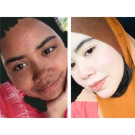 🍒MY CHERRY SKIN🍒 MCS PUTIH DALAM MASA 15 HARI 🚚 FAST DELIVERY🚨