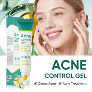 Preferred in-stock items#In-stock salicylic acid gel for acne scar repair and closed comedones treat
