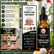 Eelhoe Nail Repair Solution Antibacerial Nail Fungus Treatment Anti Onychomycosis Paronychia Nail Re