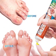 ATHLETES FOOT CREAM Krim kaki atlet anti bau kaki peluh gatal kaki Menghalang Kulat dari Tumbuh/Mere