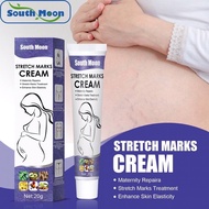 SOUTHMOON STRETCH MARKS CREAM treats stretch marks, removes stretch marks, cellulite lines, contains