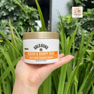 Gold Bond Rough Body Cream & Bumpy Skin