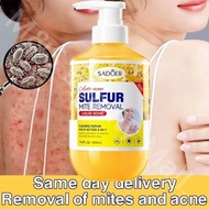 Sulfur shower gel for treating psoriasis, eczema, acne, moisturizing, exfoliating, itching, antibact