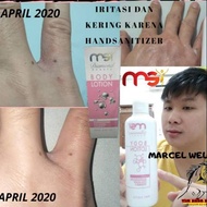 Diamond ANTI MOSQUITO LOTION REMOVES STRECHMARK BROKEN FEET DEODORANT