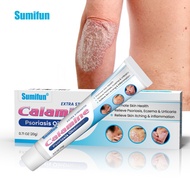 Calamine Psoriasis Ointment Eczema Cream Anti-Itch Dermatitis Pruritus Treatment