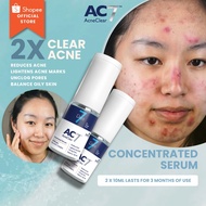 2x AC7D Serum Concentrated 10ml (Low Stock) - Acne Clear 7 Days | Acne Treatment for Acne-Prone Skin